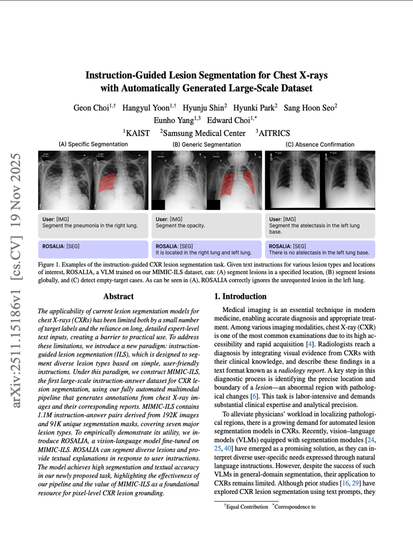 指令引导的胸部X光图像病灶分割方法及其自动构建的大规模数据集